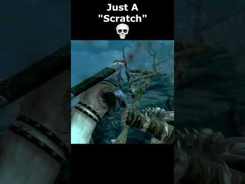 Just A "Scratch" ๐ #skyrim #skyrimanniversary #elderscrolls #shorts