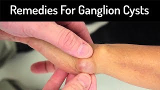 Home Remedies To Get Rid Of ganglion cyst | Remedies For ganglion cyst