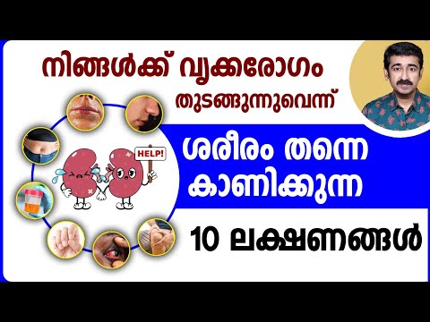 നിങ്ങൾക്ക് വൃക്കരോഗം തുടങ്ങുന്നുവെന്ന് ശരീരം തന്നെ കാണിക്കുന്ന 10 ലക്ഷണങ്ങൾ. പ്രധാനപ്പെട്ട ഇൻഫർമേഷൻ