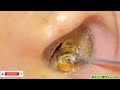 ASMR：耳の奥には、まだまだあった！