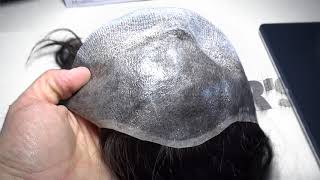 Soluzione Alopecia Protesi Capelli Totale Donne