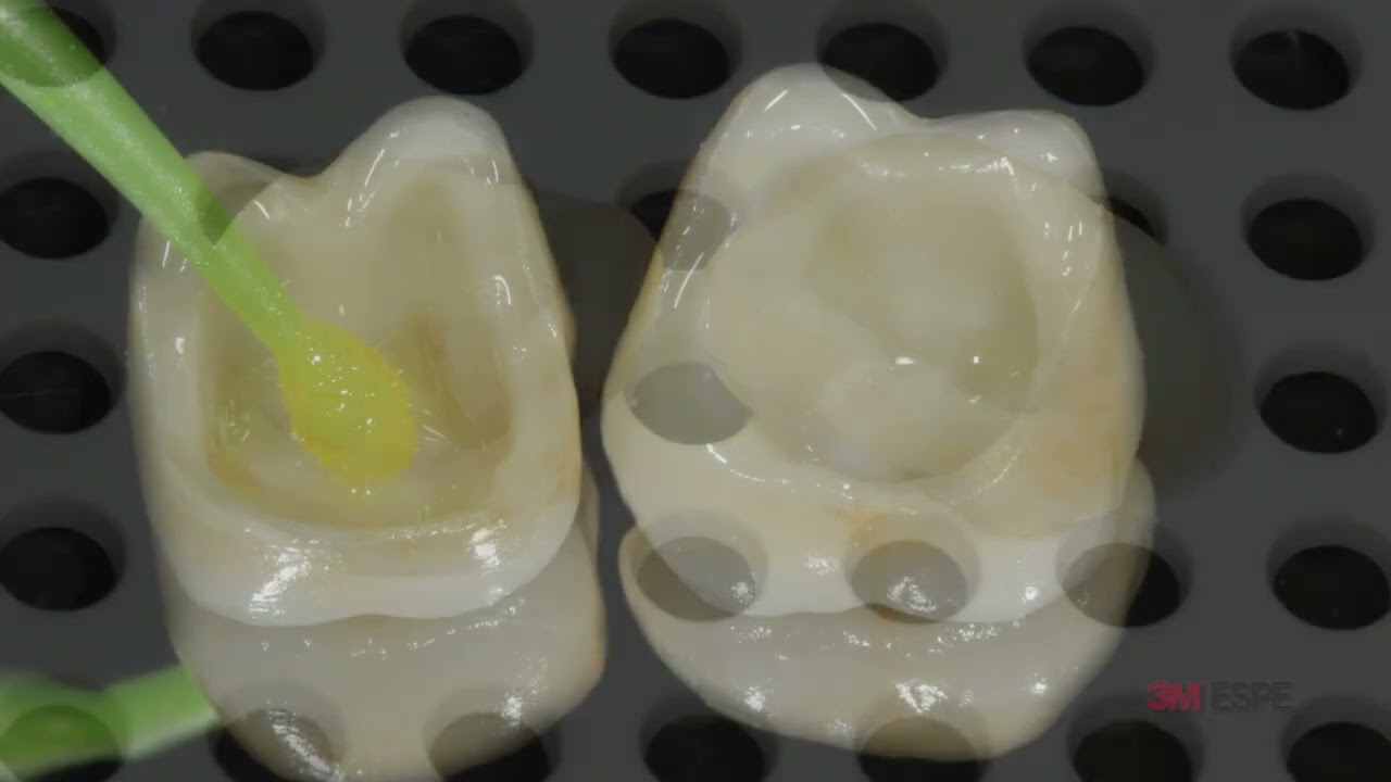 CEMENTACIÓN ZIRCONIA RELYX ULTIMATE