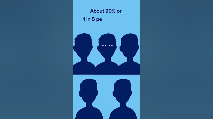 Is it normal to sleep with your eyes open?! #shorts #sleep #sleepmyths