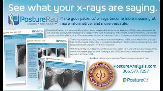 Celebrity PostureRay Computer Vision Enabled X-Ray EMR Profile