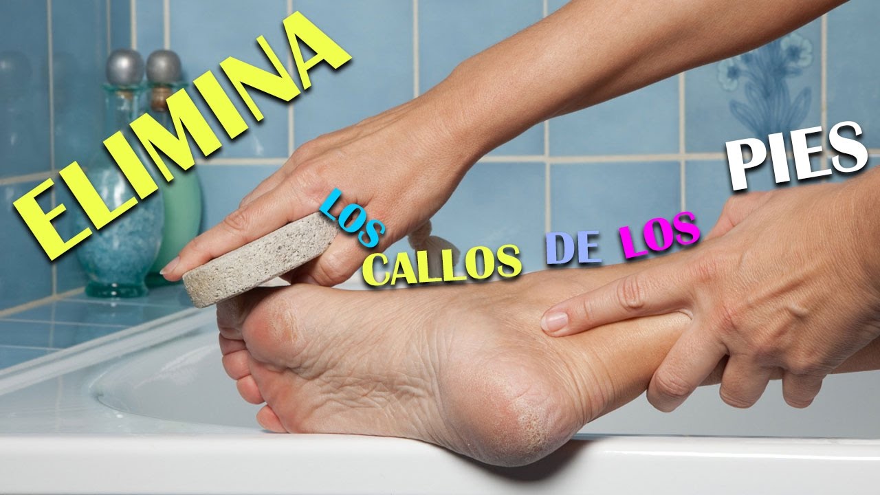 Cómo eliminar los callos de los pies