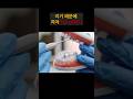 잇몸, 치아 건강 비결|잇몸염증|치아 건강|충치 예방