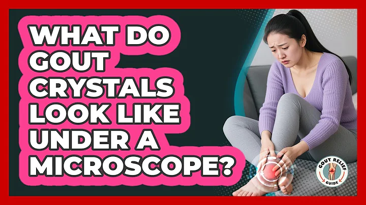 What Do Gout Crystals Look Like Under A Microscope? - Gout Relief Guide