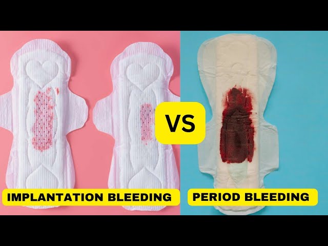 Spotting Vs. Period: Learn the Difference