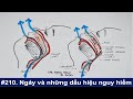 #210. Ngáy và những dấu hiệu bệnh nguy hiểm