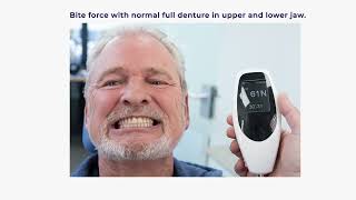 Increasing and Measuring Bite Force with Implant-Supported Dentures and Innobyte - by ProScan