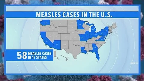 Measles cases on the rise in the U.S.