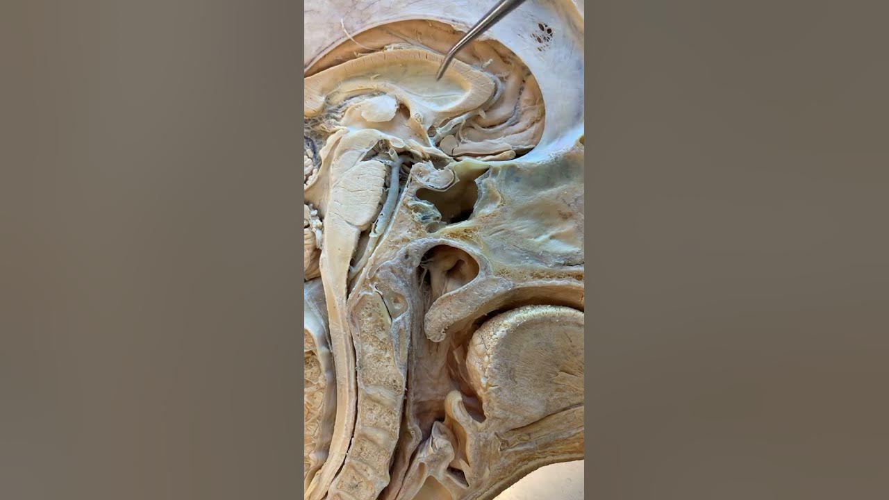 real-human-pituitary-gland-youtube