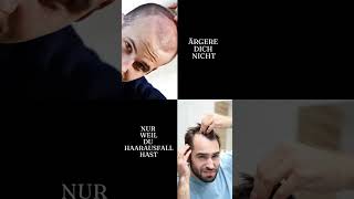 Haarausfall Männer #trending #viral #shorts