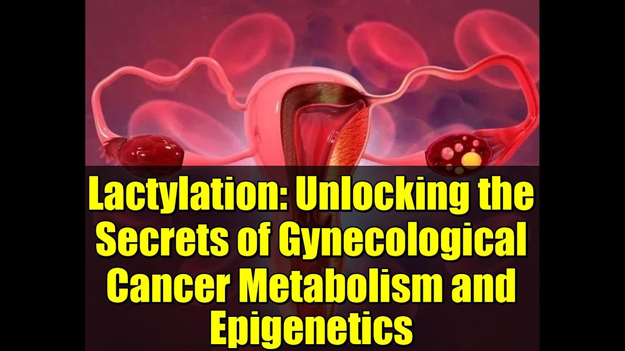 Lactylation: Unlocking the Secrets of Gynecological Cancer Metabolism and Epigenetics