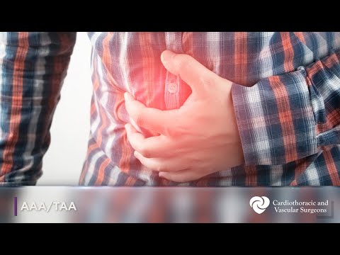 Abnormal Aortic Aneurysm | Thoracic Aortic Aneurysm | AAA Repair | TAA Repair | CTVS Texas