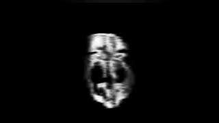 A-32 IMG B-234IMG C/-4Imc