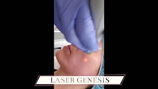 Laser & IPL Treatments in  Denver @ The Luxe Room