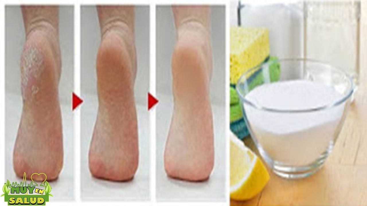 El Bicarbonato De Sodio Útil Para Dejar Tus Dedos Y Talones De Los Pies Suaves y Hermosos