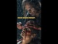 ANCIENT SURGERIES That Shouldn’t Have Worked