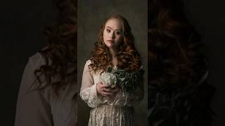 Photoshoot Of A Fashion Model With Downs Syndrome