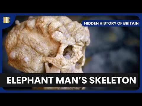 From Jack the Ripper to Joseph Merrick - Hidden History of Britain - S01 EP01 - History Documentary documentary thumbnail