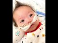 【ダウン症0歳2ヶ月】入院の面会でこんな顔されたら帰れなくなる【過去動画】 #Shorts