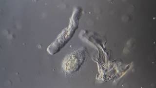 Termite Gut Symbiotic Protozoa. Protozoos Simbiontes Del Intestino De Una Termita