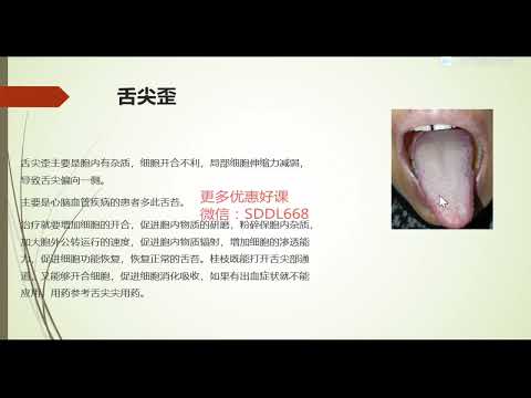 張菁蓉零基礎學舌診49  舌尖歪
