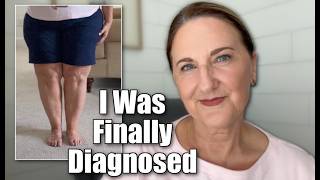 My Lipedema Diagnosis, Surgeries & Hope