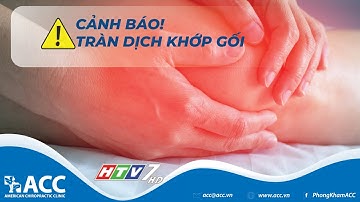 Tràn dịch khớp gối: Dấu hiệu, nguyên nhân và cách điều trị