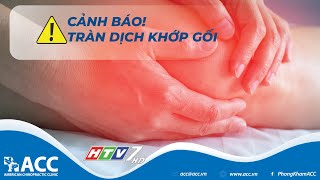 Tràn dịch khớp gối: Dấu hiệu, nguyên nhân và cách điều trị