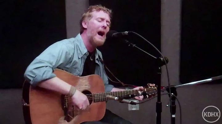 Glen Hansard "High Hope" Live at KDHX 9/25/12