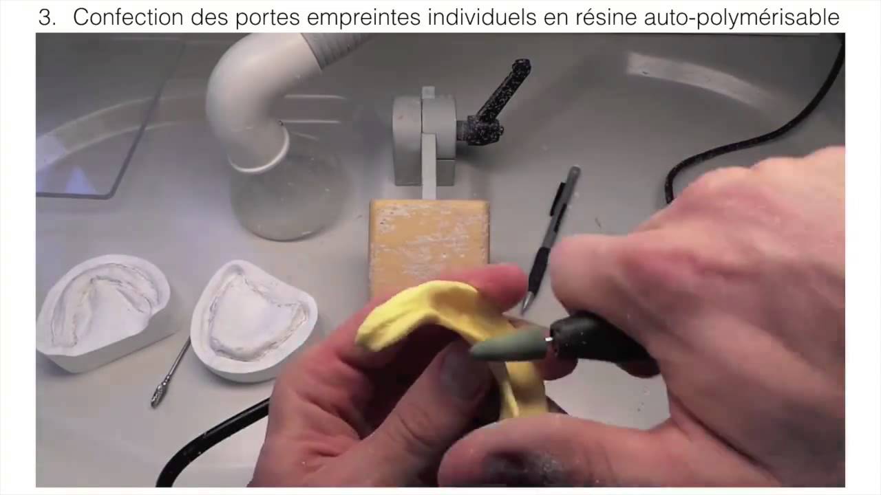 prise d'empreinte en prothese totale. fautes a eviter !!!