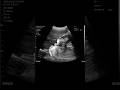 Yes, I'm pregnant. ՞😨՞ #viralvideo #cat #shorts#fyp #fypシ゚#trending #trendingshorts#cute #funny
