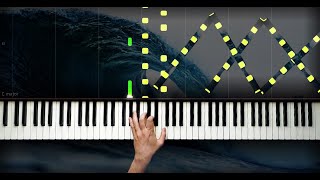 Aynı Müziği Çok Çalınca Ne Mi Olur ?