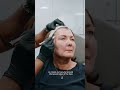 Londoners Are Choosing Sculptra - Here’s Why | - DrMediSpa