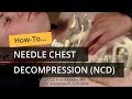 Needle Chest Decompression in TCCC