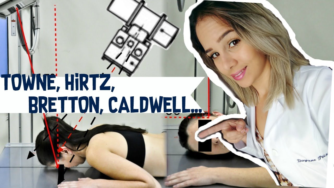 POSICIONAMENTO RADIOLÓGICO DE CRÂNIO