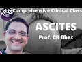 ASCITES Clinical case presentation