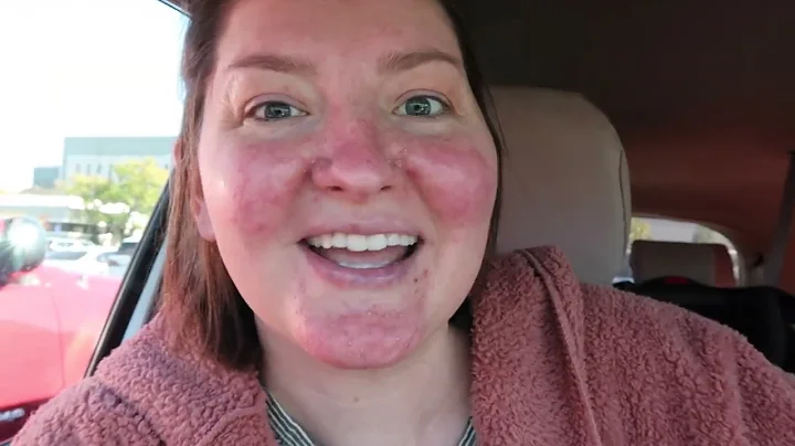 Answers From My Team - Clinical Trial - Stage 4 Lu...