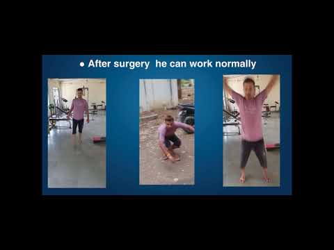 Avoiding total hip replacement in AVN hip( Indian Experience)