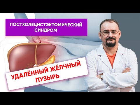 Удалённый жёлчный пузырь - постхолецистэктомический синдром.