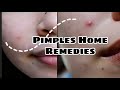 How to get rid of pimples at home stephanie grace