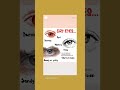 KID'S/ TEENAGERS DRY EYES RELIEF EYEGLASSES @opticiansindia