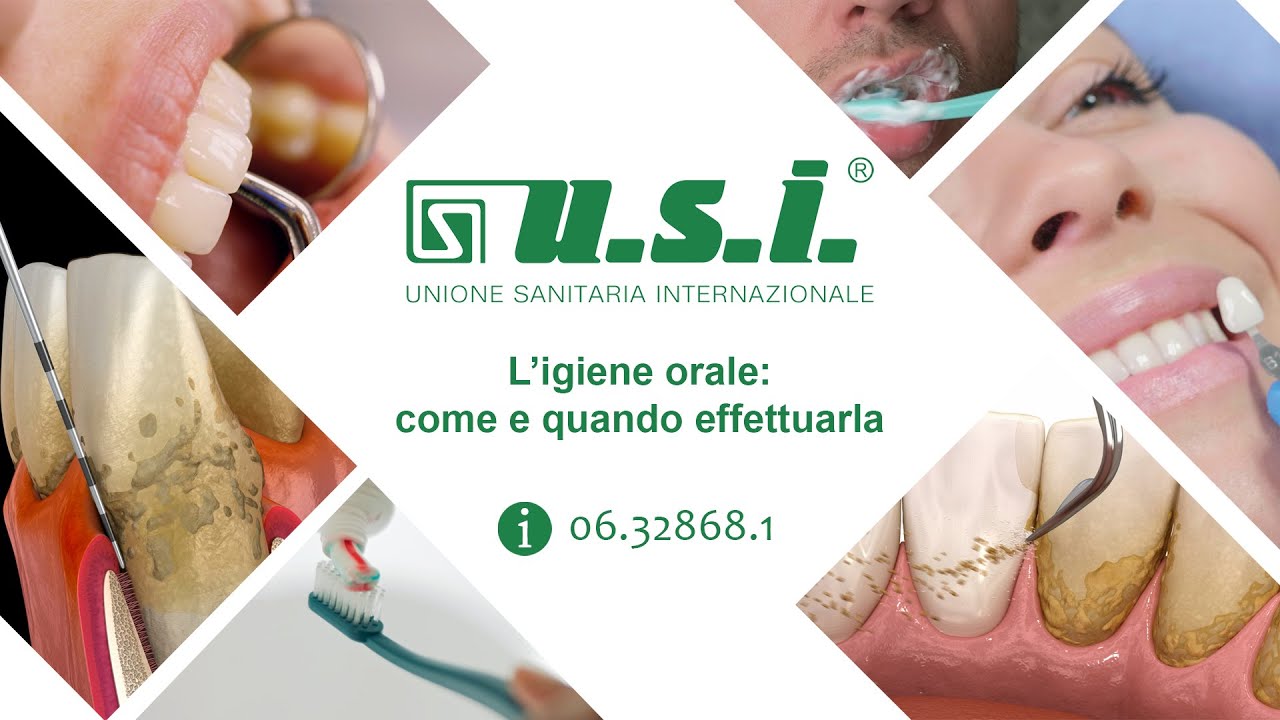 Igiene Dentale: come e quando effettuarla per una salute orale ottimale