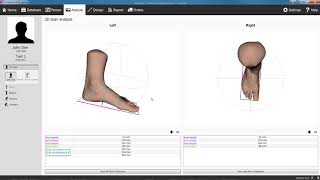 3D Foot Scanners Iqube, Tiger
