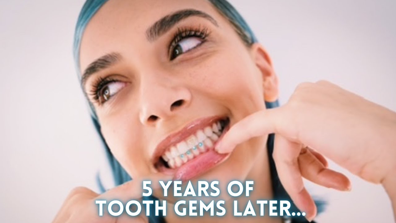 everything you need to know about  tooth gems (removal, duration, experience)