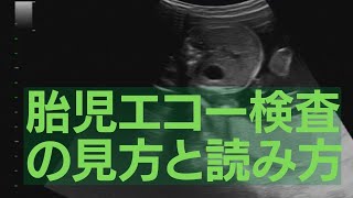 簡単！？妊娠後の胎児エコー検査の見方、読み方（19W5D Echo Video pregnancy）