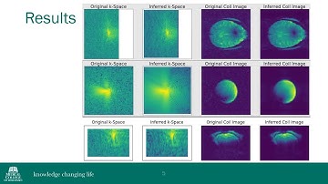 Noise reduction in MRI reconstruction with GRAPPA R=1. ISMRM 2023 abstract 4620.