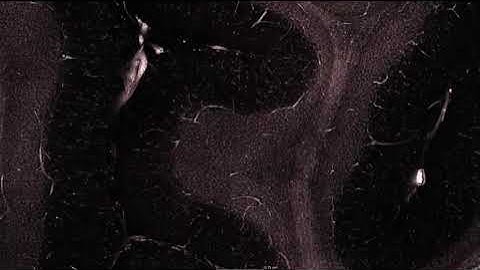 Human Brain imaged @ cellular resolution. (Multiscale HiP-CT imaging)